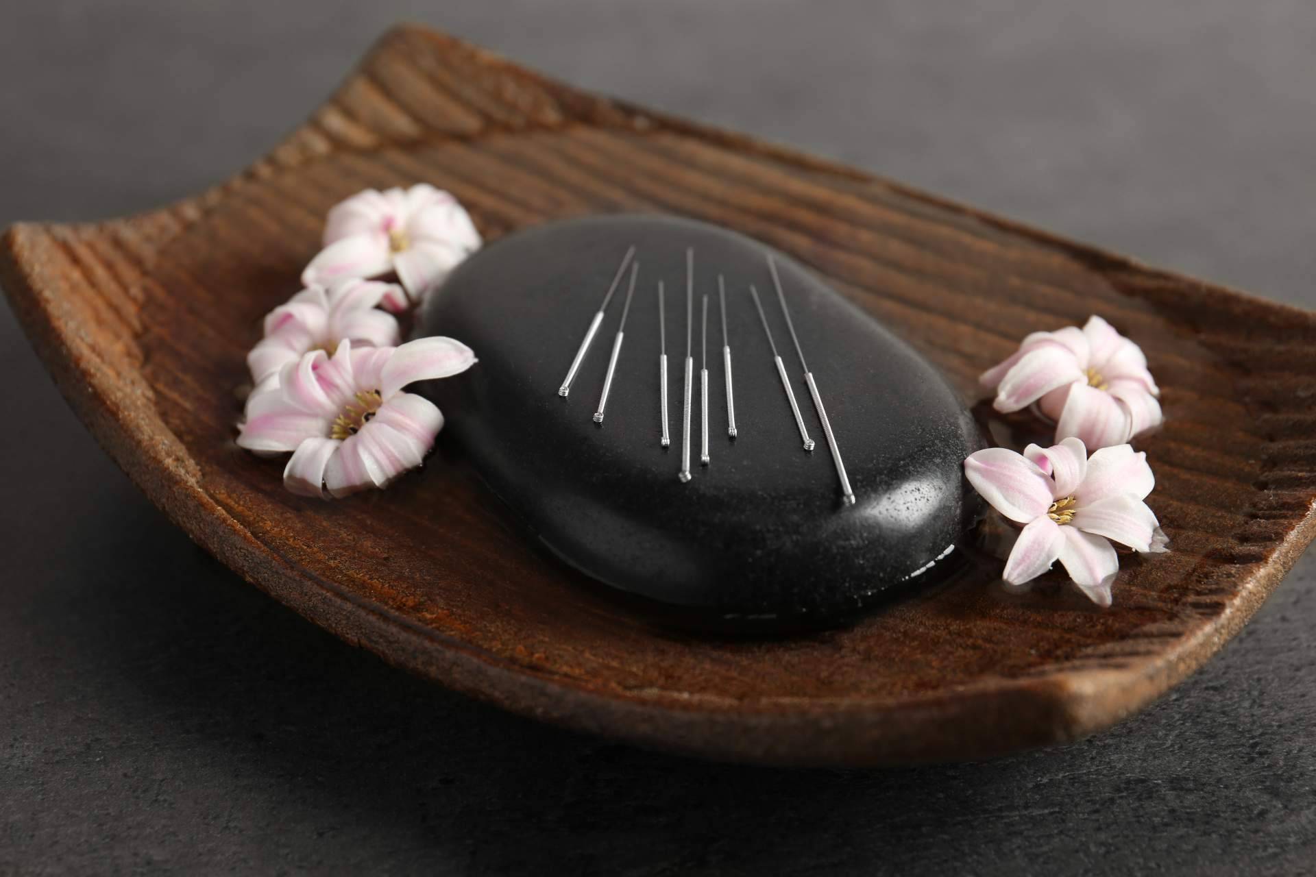 Las terapias de acupuntura de Shenti Wellness