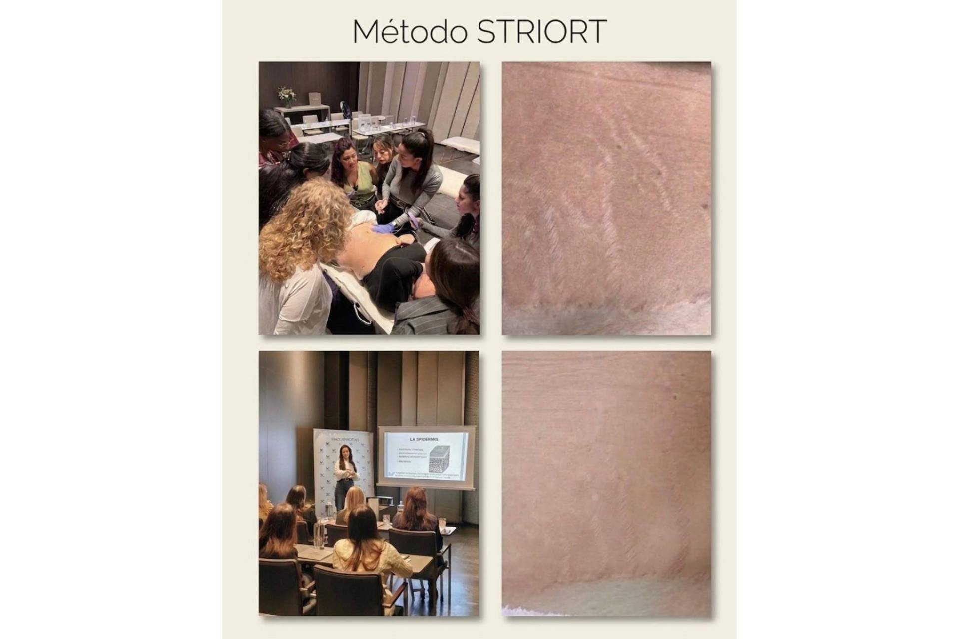 STRIORT aterriza en España con su formación oficial para estrías tras consolidarse en más de 30 países
